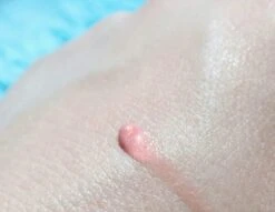 Biodermal Sun Lipbalm SPF25 - Tube 12 Ml - Natural Pink - Lippenbalsem -Chique Cosmetica Winkel 1200x927 1